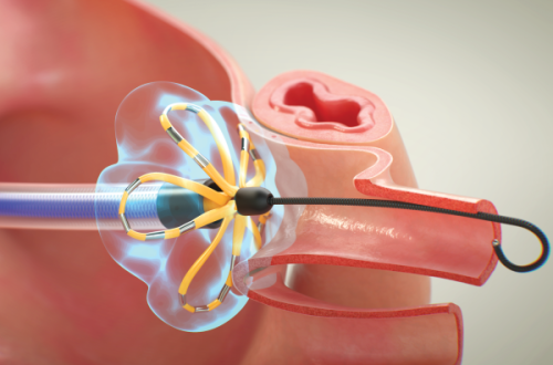 FP_System_cropped_600x400